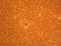 Extreme Anzahl von Flagellaten unter dem Mikroskop