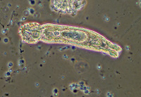 Hautwurm eines Schleierschwanzes unter dem Mikroskop