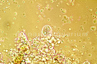 Hauttrüber Chilodonella unter dem Mikroskop